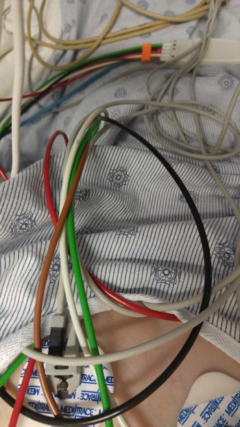 hospital wires